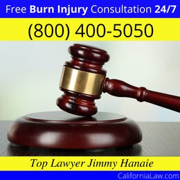 Aguanga Burn Injury Attorney