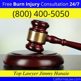 Alameda Burn Injury Attorney