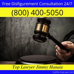 Alderpoint Disfigurement Lawyer CA
