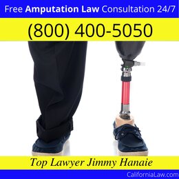 Best Amputation Lawyer For Berkeley