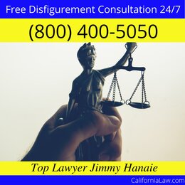 Best Disfigurement Lawyer For Shaver Lake