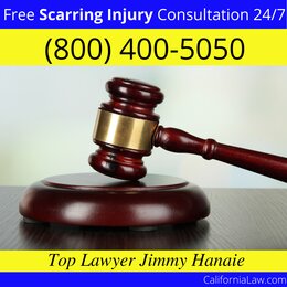 Big Bar Scarring Injury Lawyer CA