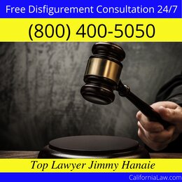 Big Sur Disfigurement Lawyer CA