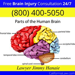 La Mirada Brain Injury Lawyer CA