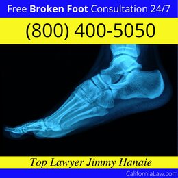 Acampo Broken Foot Lawyer