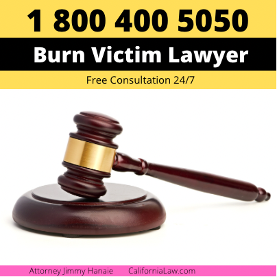 Acampo Burn Victim Attorney