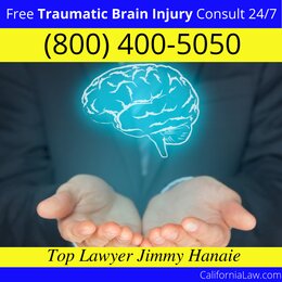 Acampo Traumatic Brain Injury Lawyer CA