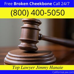 Agoura Hills Broken Cheekbone Lawyer