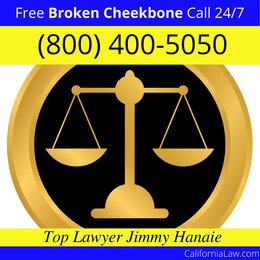 Alta Loma Broken Cheekbone Lawyer