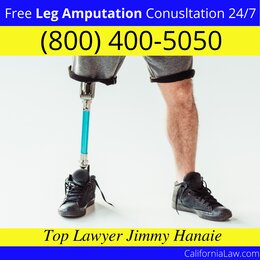 Alviso Leg Amputation Lawyer