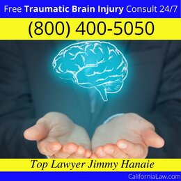 Anderson Traumatic Brain Injury Lawyer CA