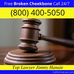 Applegate Broken Cheekbone Lawyer