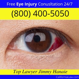 Badger Eye Injury Lawyer CA