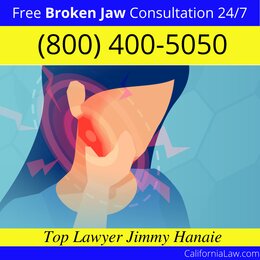 Best Acampo Broken Jaw Lawyer