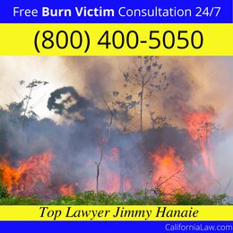 Best Acampo Burn Victim Lawyer