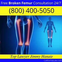 Best Aguanga Broken Femur Lawyer