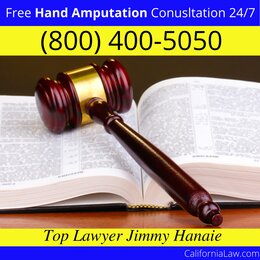 Best Aguanga Hand Amputation Lawyer