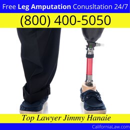 Best Alameda Leg Amputation Lawyer