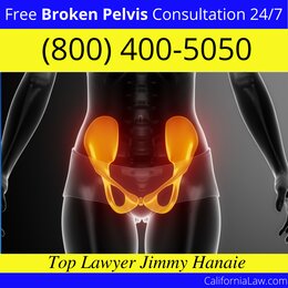 Best Big Sur Broken Pelvis Lawyer