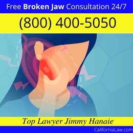 Best Burbank Broken Jaw Lawyer
