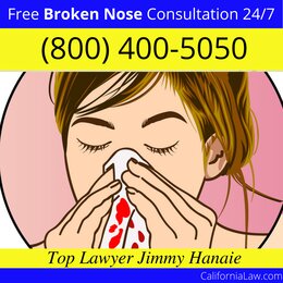 Best El Segundo Broken Nose Lawyer