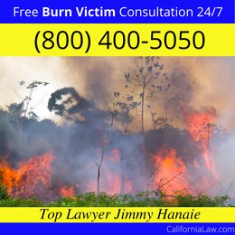 Best Fullerton Burn Victim Lawyer