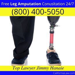 Best Nicasio Leg Amputation Lawyer