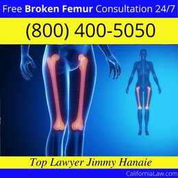 Best San Clemente Broken Femur Lawyer