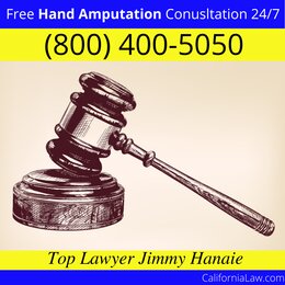 Burson Hand Amputation Lawyer