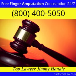 Caliente Finger Amputation Lawyer