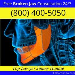 California Hot Springs Broken Jaw Lawyer