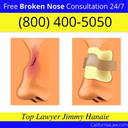 California Hot Springs Broken Nose Lawyer