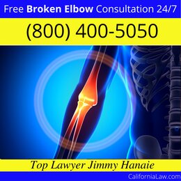 Carmel Valley Broken Elbow Lawyer