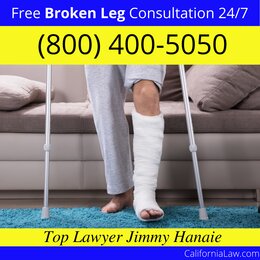 Copperopolis Broken Leg Lawyer