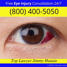 El Segundo Eye Injury Lawyer CA