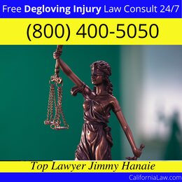 Adelanto Degloving Injury Lawyer CA