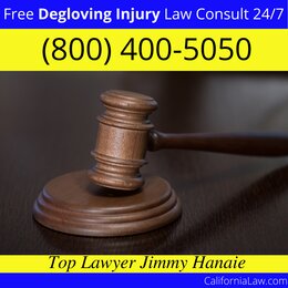 Best Degloving Injury Lawyer For Alderpoint