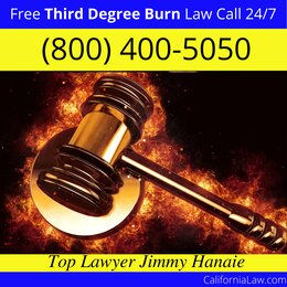 Best Third Degree Burn Injury Lawyer For Ahwahnee