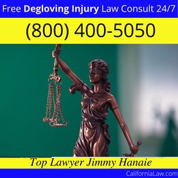Big Pine Degloving Injury Lawyer CA