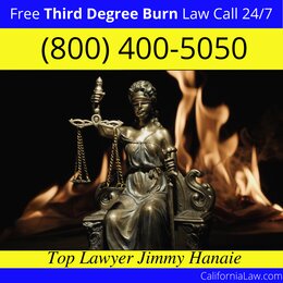 California City Third Degree Burn Injury Attorney