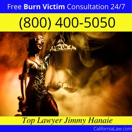 Burn Victim Attorney California