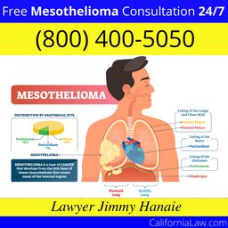 Mesothelioma Hotline Lawyer For California