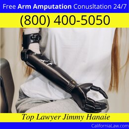 Arm Amputation Help Lawyer California