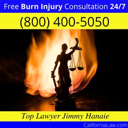 Burn Injury Assistance Lawyer For California